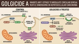 Golgicide A inhibits ARF1 GTPase to modulate circular dorsal ruffle dimensions in hepatocellular carcinoma