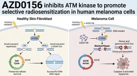 AZD0156 inhibits ATM kinase to promote selective radiosensitization in human melanoma cells