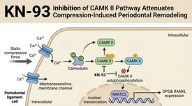 KN-93 Inhibition of CAMK II Pathway Attenuates Compression-Induced Periodontal Remodeling