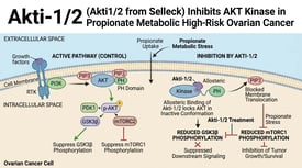 Akti-1/2 (Akti1/2 from Selleck) Inhibits AKT Kinase in Propionate Metabolic High-Risk Ovarian Cancer