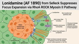 Lonidamine (AF 1890) from Selleck Suppresses Focus Expansion via RhoA ROCK Myosin II Pathway